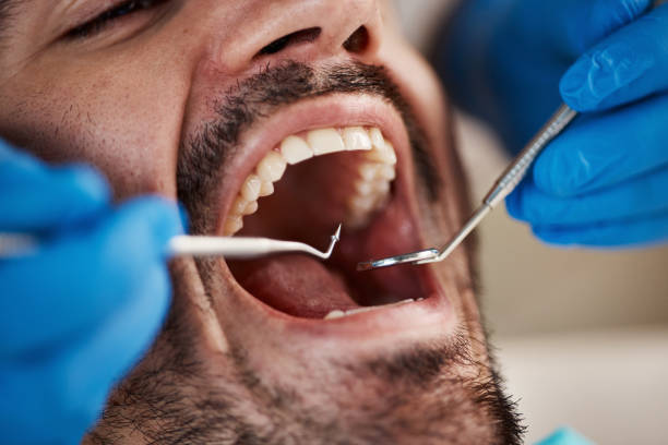 Best Emergency Denture Repair in Plainview, NY